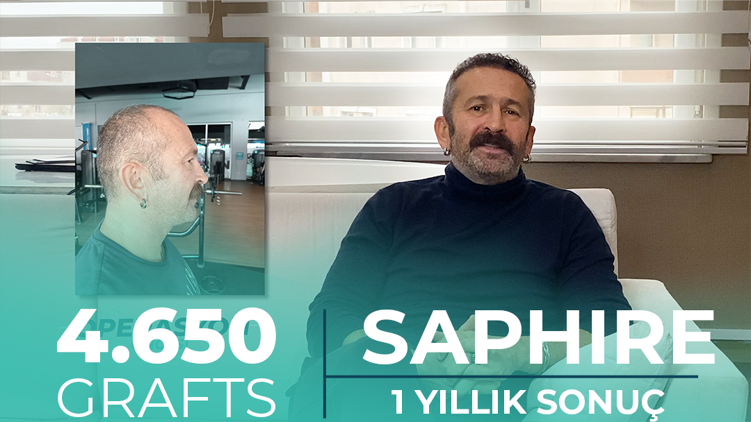 Safir FUE Saç Ekim Sonuçları